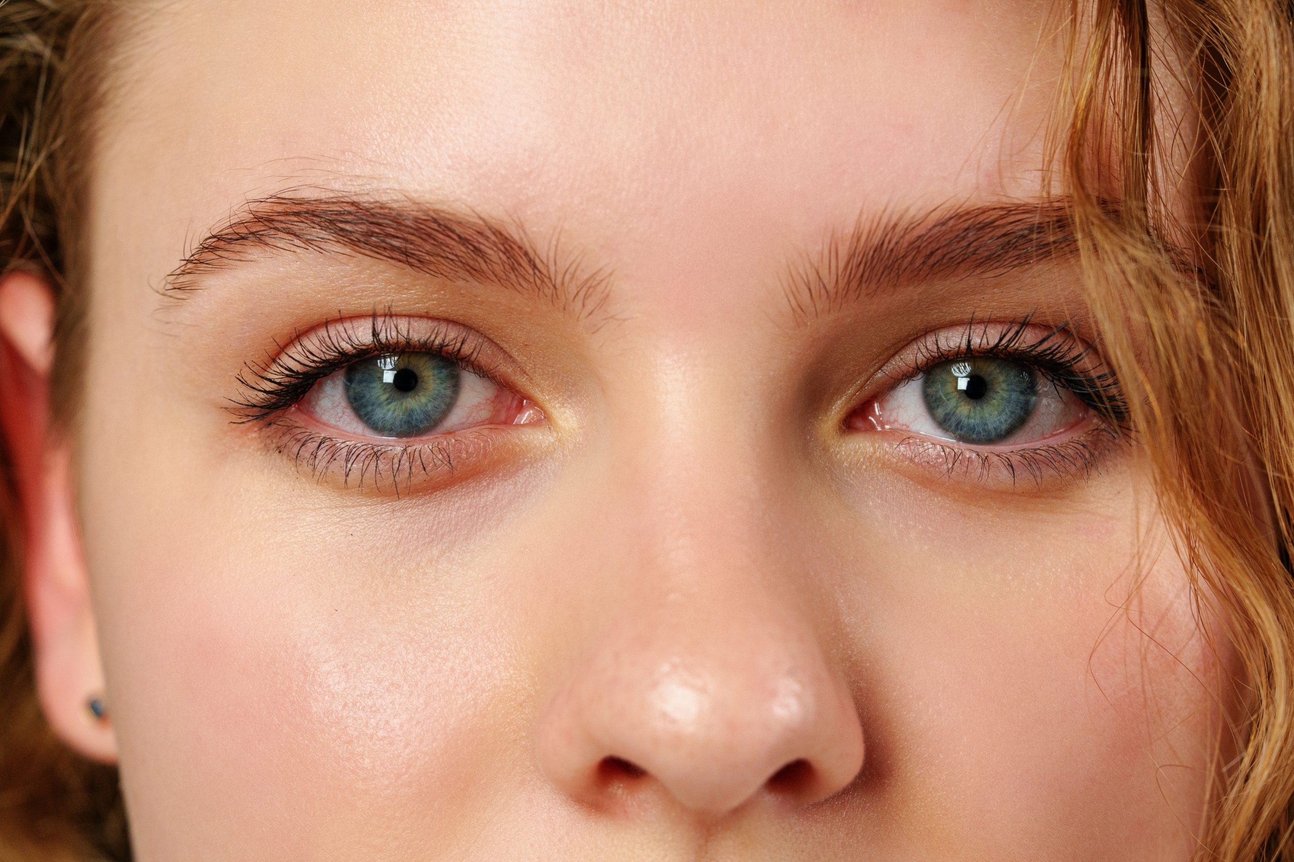 How to Identify and Treat Your Eye Condition
